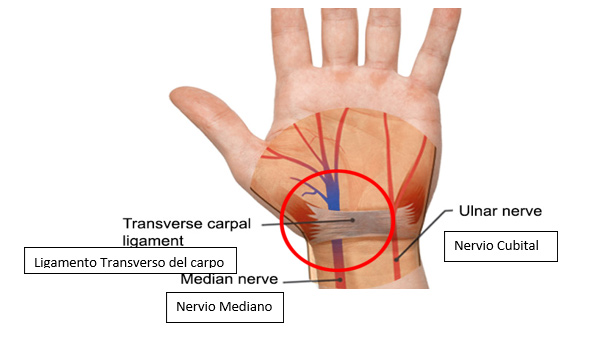 Carpal Tunnel Release