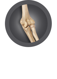 Elbow Surgery