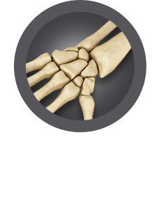 Wrist Surgery