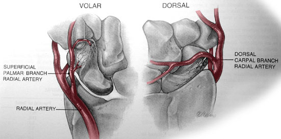 Scaphoid Fracture