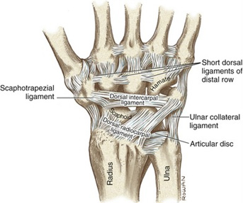 Wrist Sprain